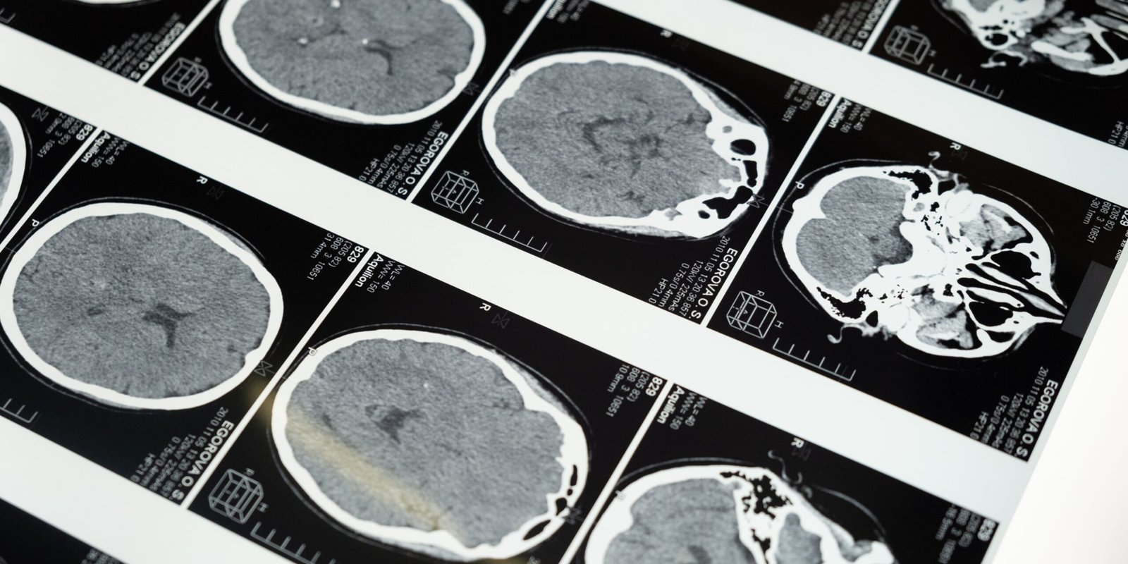 The Brain Chronicles: A Deep Dive into Cognitive Marvels